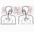 Лечение туберкулеза и роль медицинской сестры 